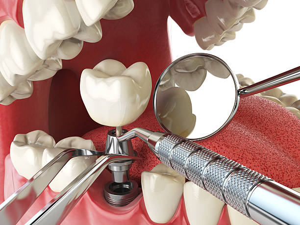 Best Emergency Dental Care for Broken or Chipped Teeth in Grandview, OK